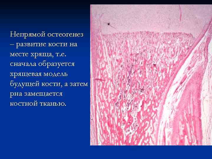 Непрямой остеогенез – развитие кости на месте хряща, т. е. сначала образуется хрящевая модель