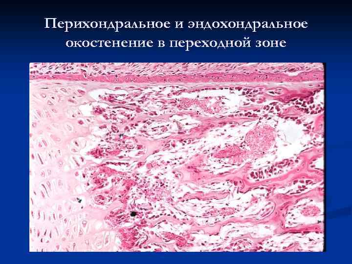 Перихондральное и эндохондральное окостенение в переходной зоне 