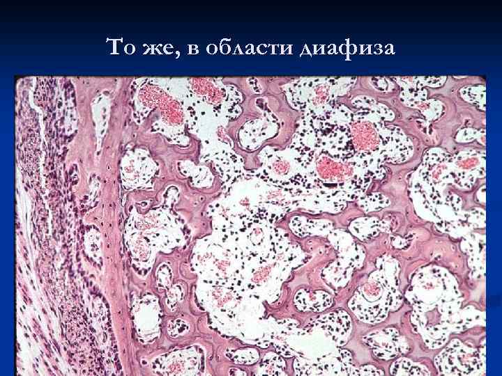 То же, в области диафиза 