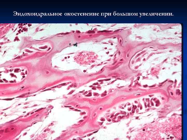 Эндохондральное окостенение при большом увеличении. 
