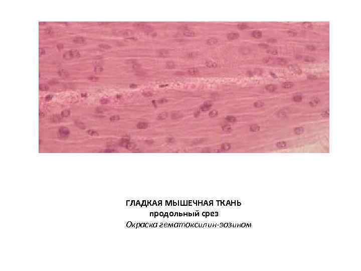 ГЛАДКАЯ МЫШЕЧНАЯ ТКАНЬ продольный срез Окраска гематоксилин-эозином 