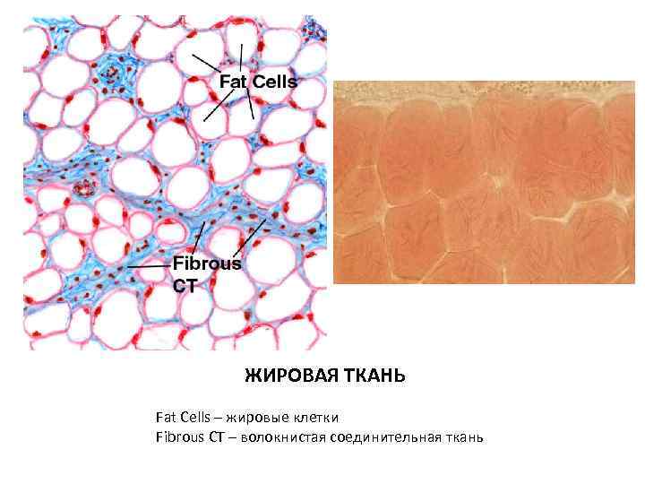 Соединительная жировая ткань рисунок