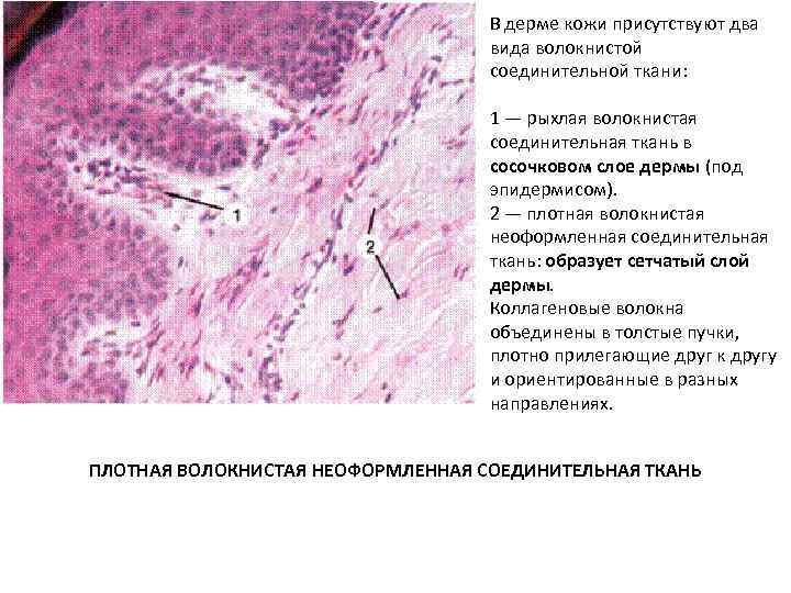 В дерме кожи присутствуют два вида волокнистой соединительной ткани: 1 — рыхлая волокнистая соединительная