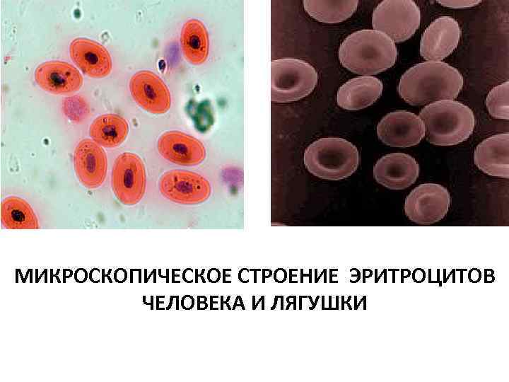 МИКРОСКОПИЧЕСКОЕ СТРОЕНИЕ ЭРИТРОЦИТОВ ЧЕЛОВЕКА И ЛЯГУШКИ 