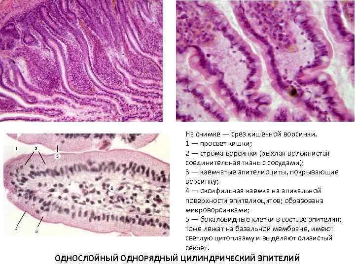 На снимке — срез кишечной ворсинки. 1 — просвет кишки; 2 — строма ворсинки