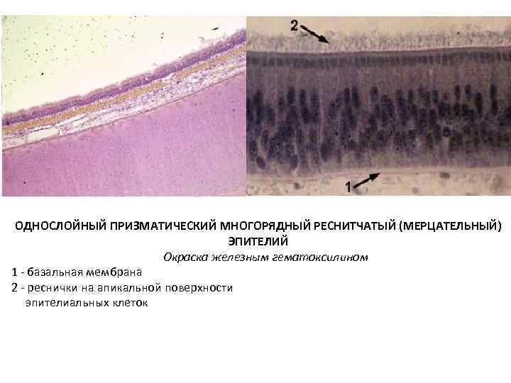 ОДНОСЛОЙНЫЙ ПРИЗМАТИЧЕСКИЙ МНОГОРЯДНЫЙ РЕСНИТЧАТЫЙ (МЕРЦАТЕЛЬНЫЙ) ЭПИТЕЛИЙ Окраска железным гематоксилином 1 - базальная мембрана 2