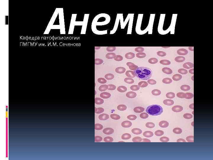 Анемии Кафедра патофизиологии ПМГМУ им. И. М. Сеченова 