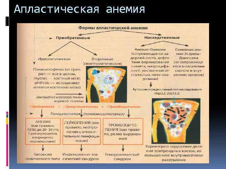 Апластическая анемия 