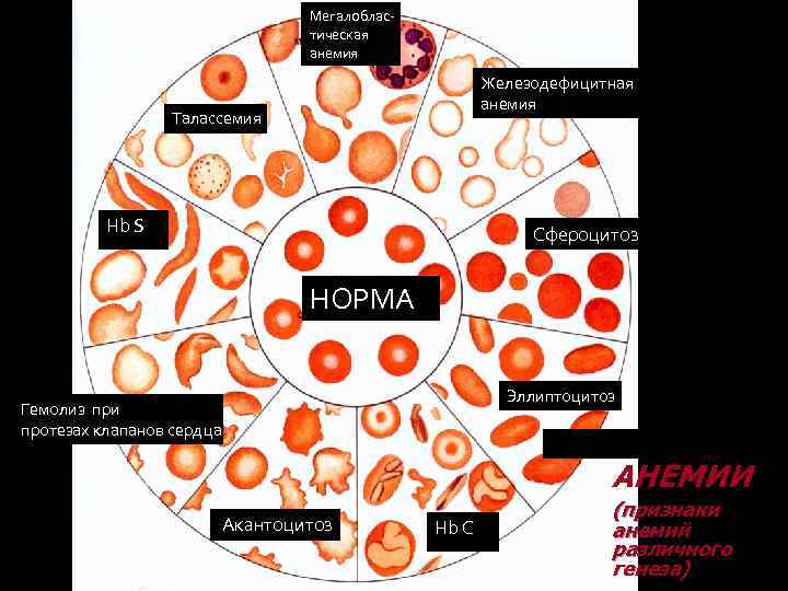 Анемии патофизиология презентация