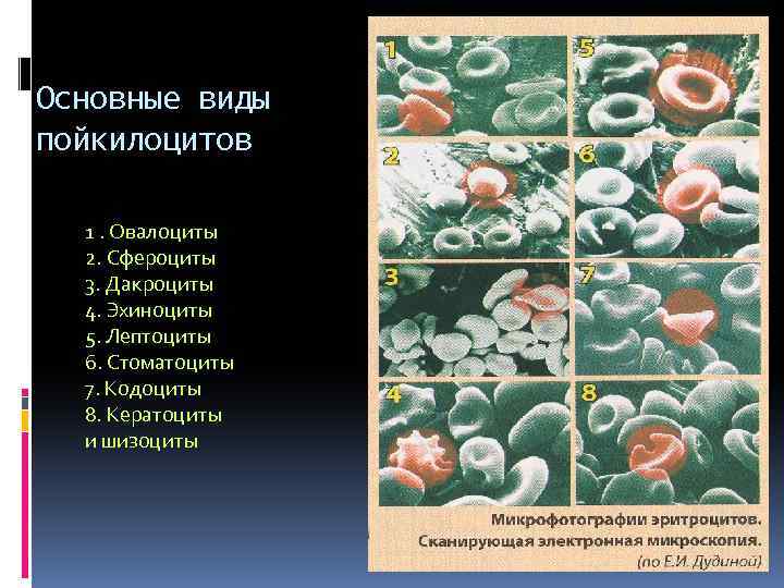 Основные виды пойкилоцитов 1. Овалоциты 2. Сфероциты 3. Дакроциты 4. Эхиноциты 5. Лептоциты 6.