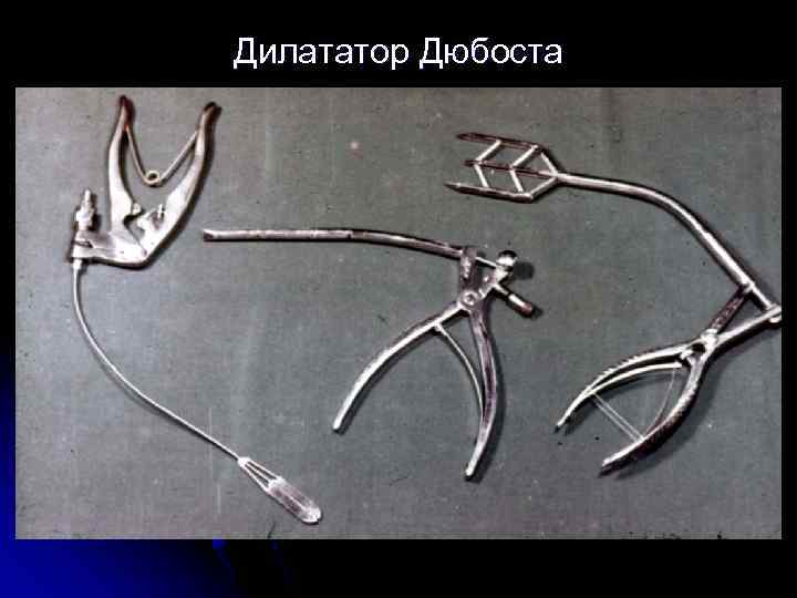 Дилататор Дюбоста 