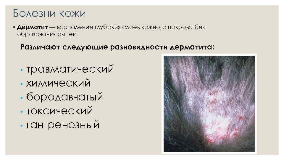Болезни кожи ◦ Дерматит — воспаление глубоких слоев кожного покрова без образования сыпей. Различают