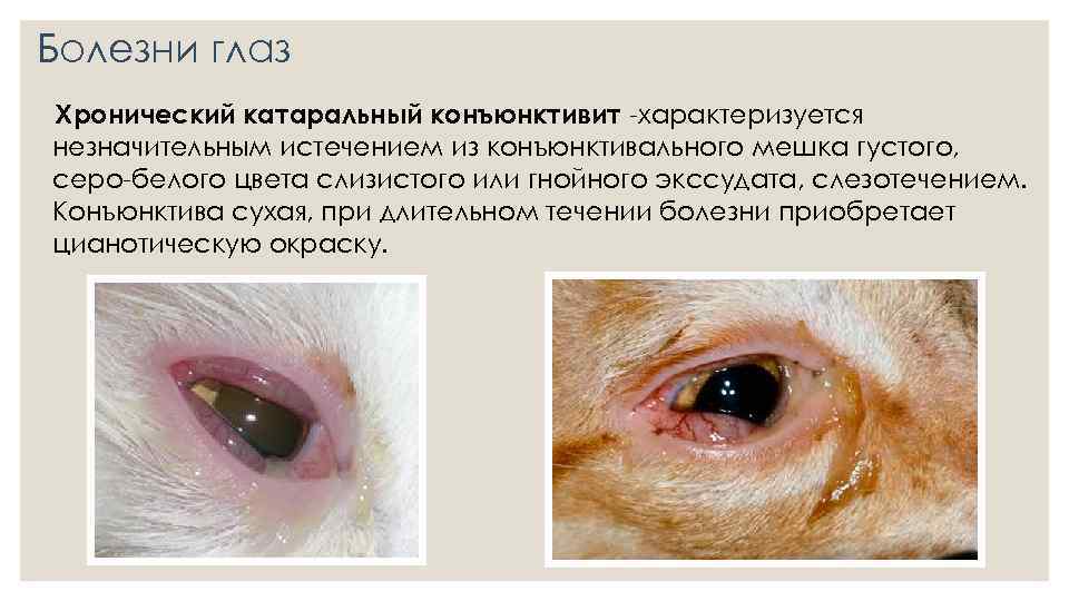 Болезни глаз Хронический катаральный конъюнктивит характеризуется незначительным истечением из конъюнктивального мешка густого, серо белого