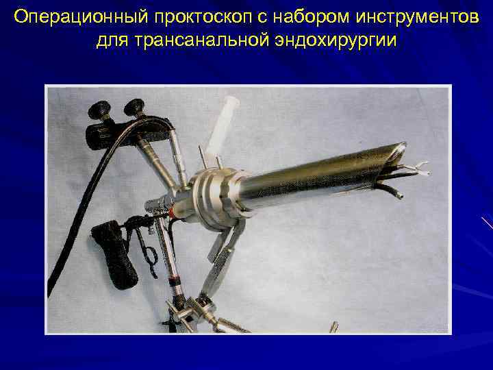 Операционный проктоскоп с набором инструментов для трансанальной эндохирургии 
