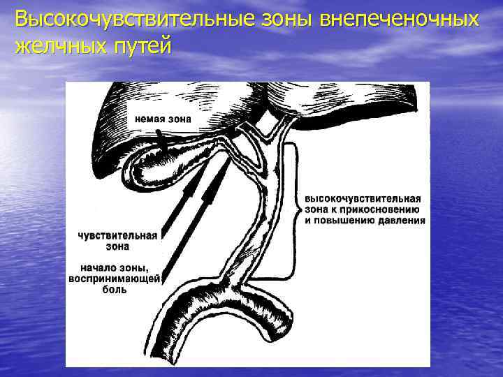 Высокочувствительные зоны внепеченочных желчных путей 