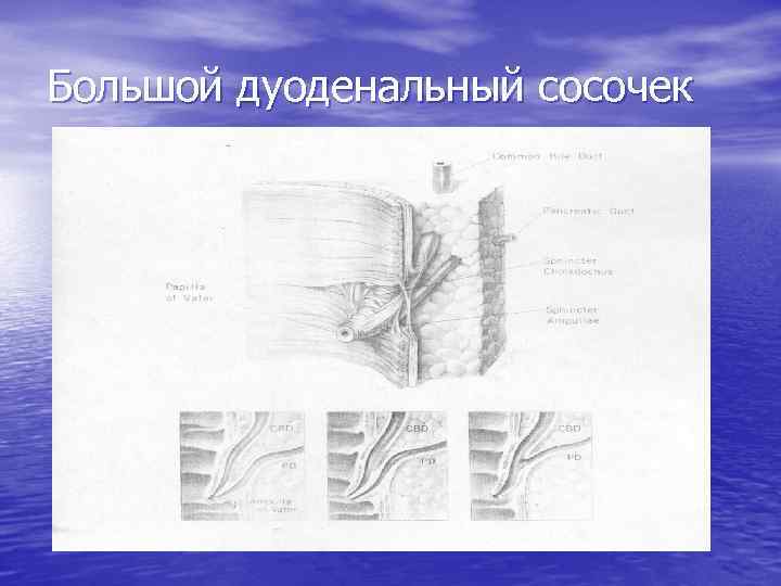 Большой дуоденальный сосочек 