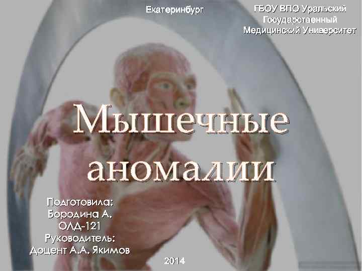 Екатеринбург ГБОУ ВПО Уральский Государственный Медицинский Университет Мышечные аномалии Подготовила: Бородина А. ОЛД-121 Руководитель: