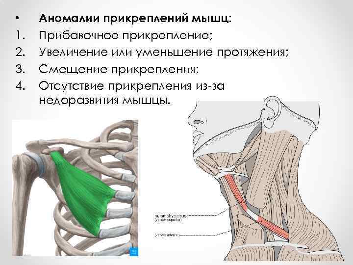  • 1. 2. 3. 4. Аномалии прикреплений мышц: Прибавочное прикрепление; Увеличение или уменьшение