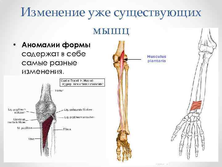 Изменение уже существующих мышц • Аномалии формы содержат в себе самые разные изменения. 