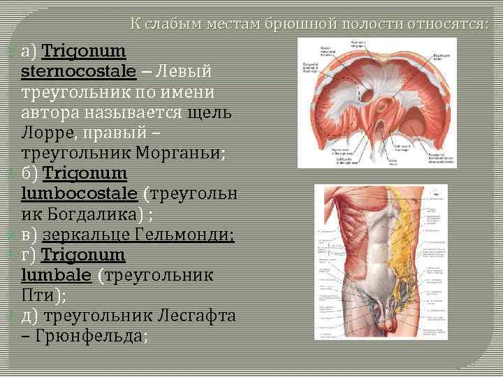 К слабым местам брюшной полости относятся: а) Trigonum sternocostale – Левый треугольник по имени