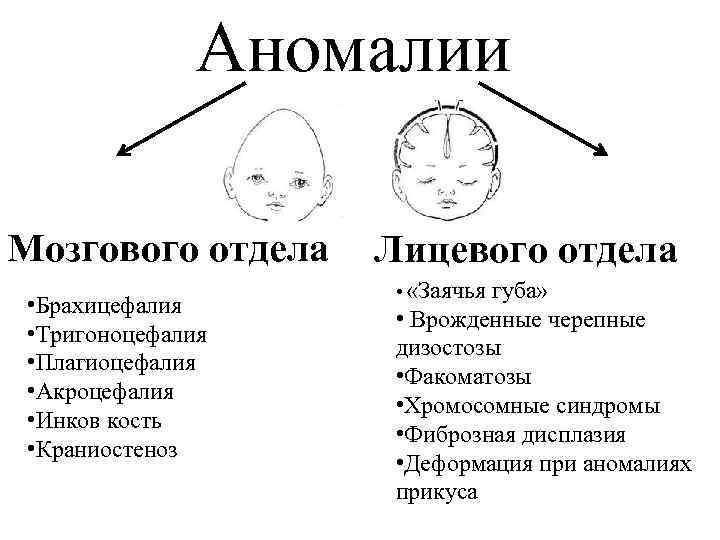 Аномалии мозгового черепа