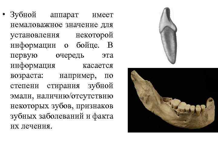  • Зубной аппарат имеет немаловажное значение для установления некоторой информации о бойце. В
