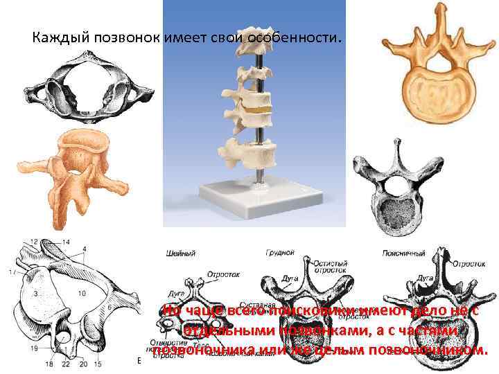 Каждый позвонок имеет свои особенности. Но чаще всего поисковики имеют дело не с отдельными
