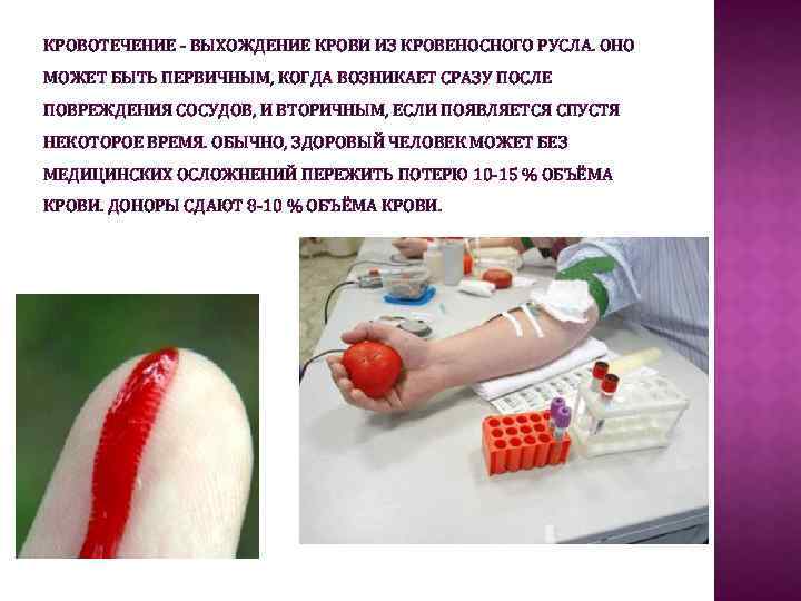 КРОВОТЕЧЕНИЕ - ВЫХОЖДЕНИЕ КРОВИ ИЗ КРОВЕНОСНОГО РУСЛА. ОНО МОЖЕТ БЫТЬ ПЕРВИЧНЫМ, КОГДА ВОЗНИКАЕТ СРАЗУ