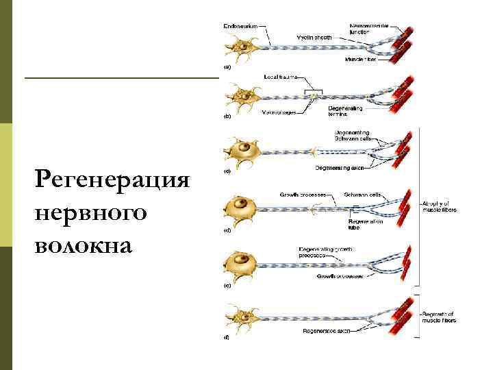 Регенерация нервного волокна 