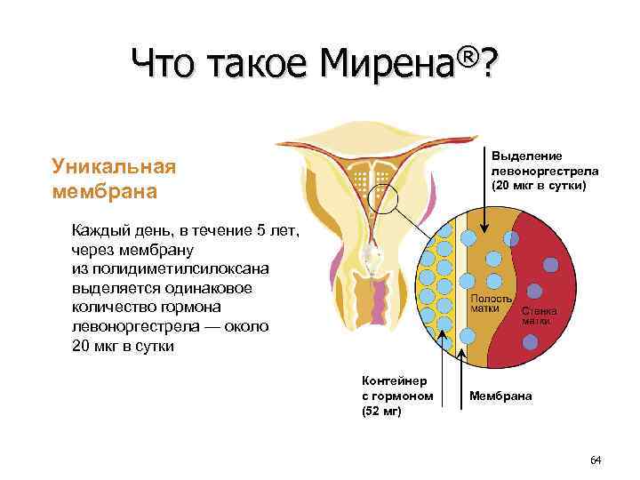 Что такое Мирена®? Выделение левоноргестрела (20 мкг в сутки) Уникальная мембрана Каждый день, в