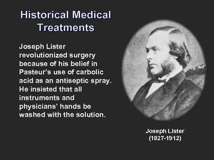 Historical Medical Treatments Joseph Lister revolutionized surgery because of his belief in Pasteur’s use