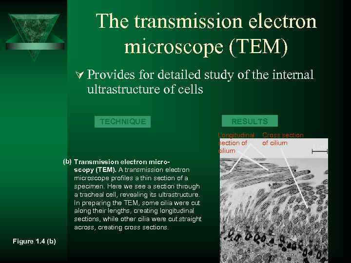 The transmission electron microscope (TEM) Ú Provides for detailed study of the internal ultrastructure