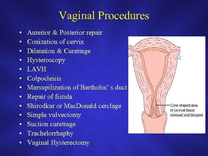 Vaginal Procedures • • • • Anterior & Posterior repair Conization of cervix Dilatation