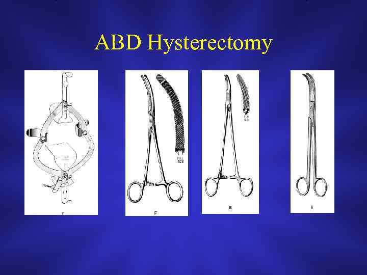 ABD Hysterectomy 