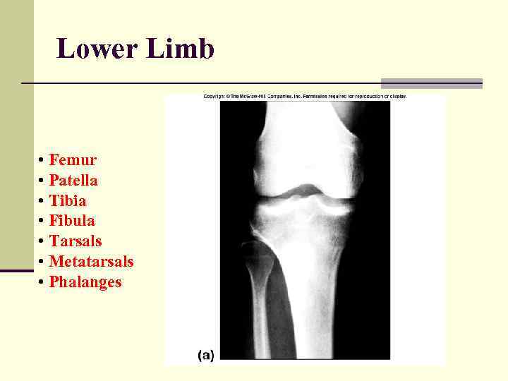 Lower Limb • Femur • Patella • Tibia • Fibula • Tarsals • Metatarsals