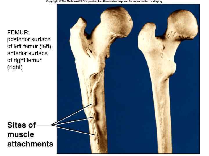 FEMUR: posterior surface of left femur (left); anterior surface of right femur (right) 