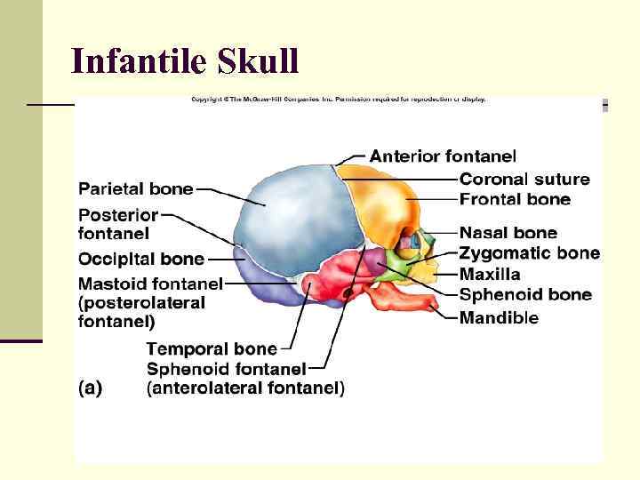 Infantile Skull 