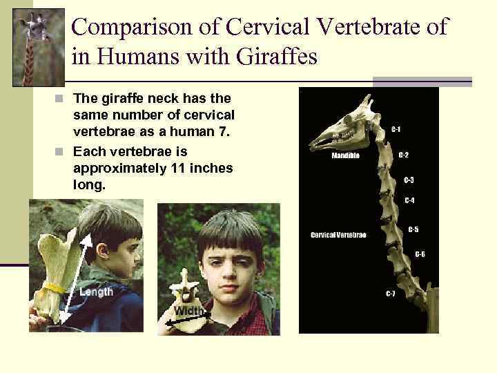 Comparison of Cervical Vertebrate of in Humans with Giraffes n The giraffe neck has