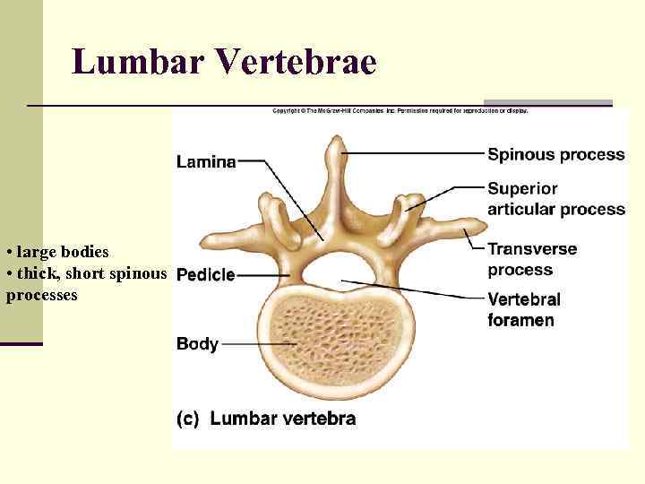 Lumbar Vertebrae • large bodies • thick, short spinous processes 