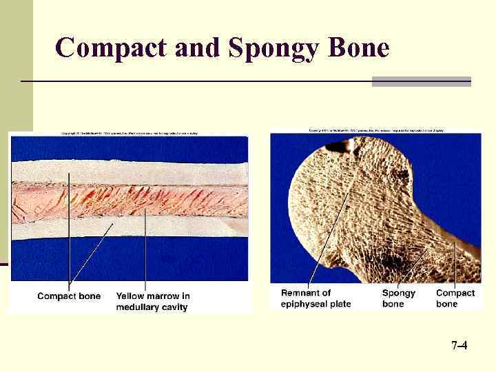 Compact and Spongy Bone 7 -4 