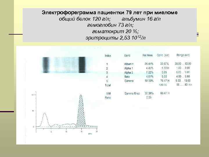 М градиент. М градиент при миеломной. Миеломная болезнь белковые фракции. Электрофореграмма при миеломной болезни. Белковые фракции при миеломной болезни.