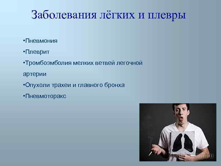 Заболевания лёгких и плевры • Пневмония • Плеврит • Тромбоэмболия мелких ветвей легочной артерии