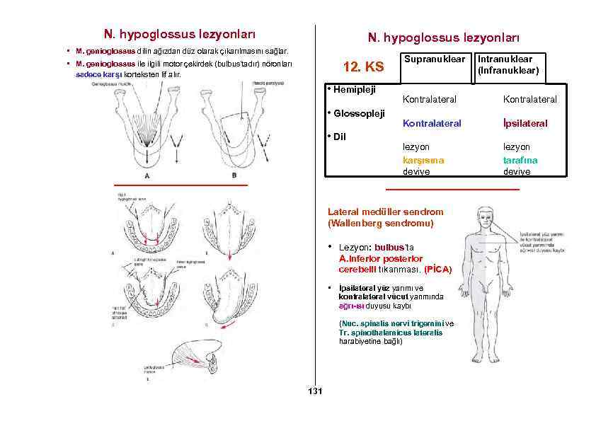 N. hypoglossus lezyonları • M. genioglossus dilin ağızdan düz olarak çıkarılmasını sağlar. 12. KS