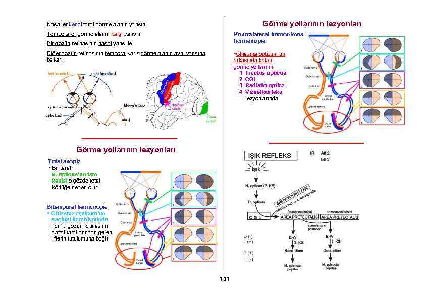 Görme yollarının lezyonları Nasaller kendi taraf görme alanın yarısını Kontralateral homonimos hemianopia Temporaller görme