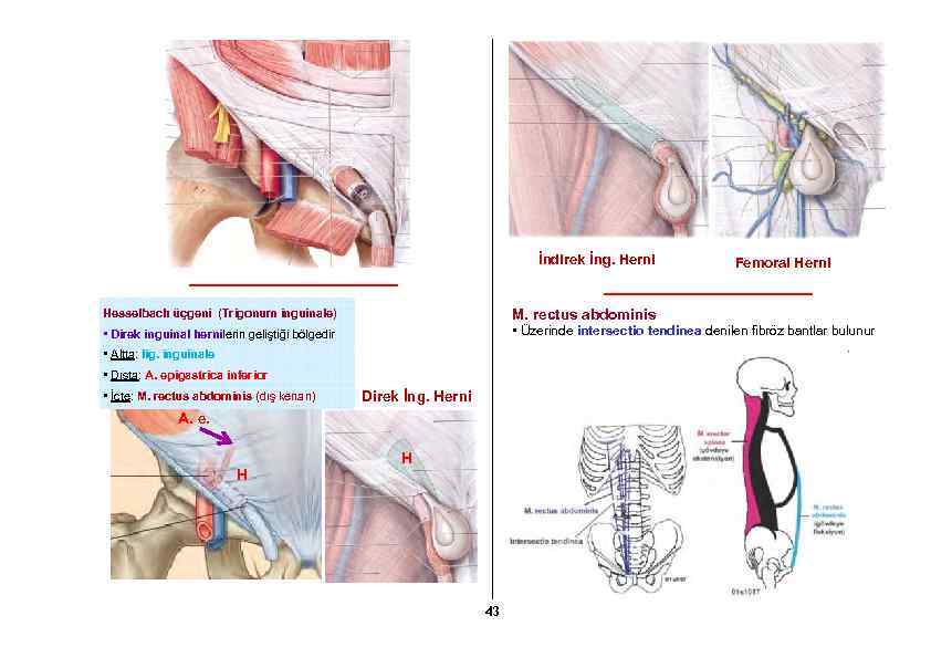 İndirek İng. Herni Femoral Herni Hesselbach üçgeni (Trigonum inguinale) M. rectus abdominis • Direk