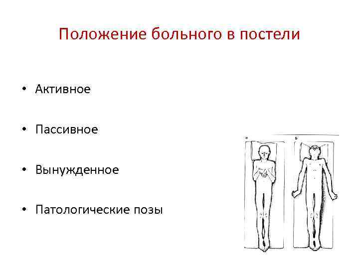 Положение больного в постели • Активное • Пассивное • Вынужденное • Патологические позы 
