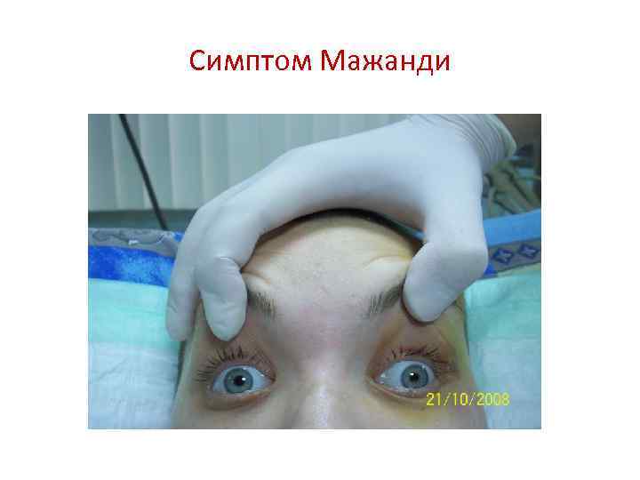 Симптом Мажанди 