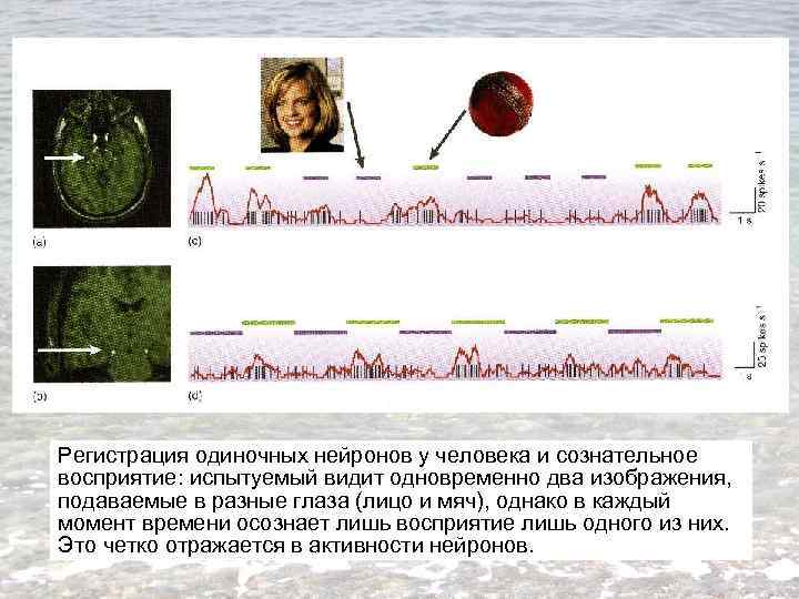 Регистрация одиночных нейронов у человека и сознательное восприятие: испытуемый видит одновременно два изображения, подаваемые