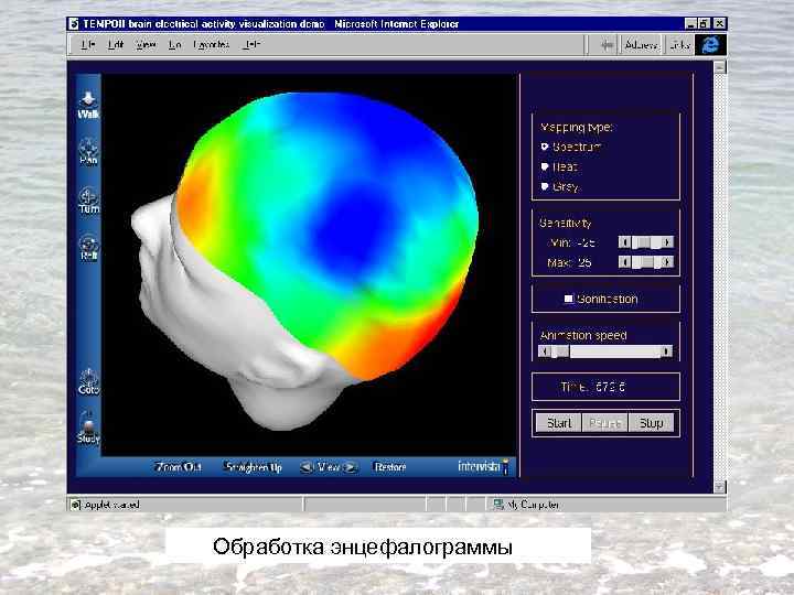 Обработка энцефалограммы 