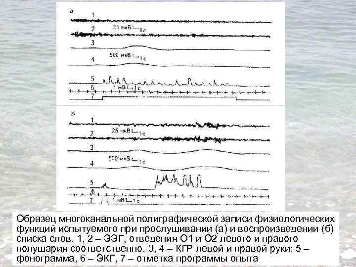 Образец многоканальной полиграфической записи физиологических функций испытуемого при прослушивании (а) и воспроизведении (б) списка